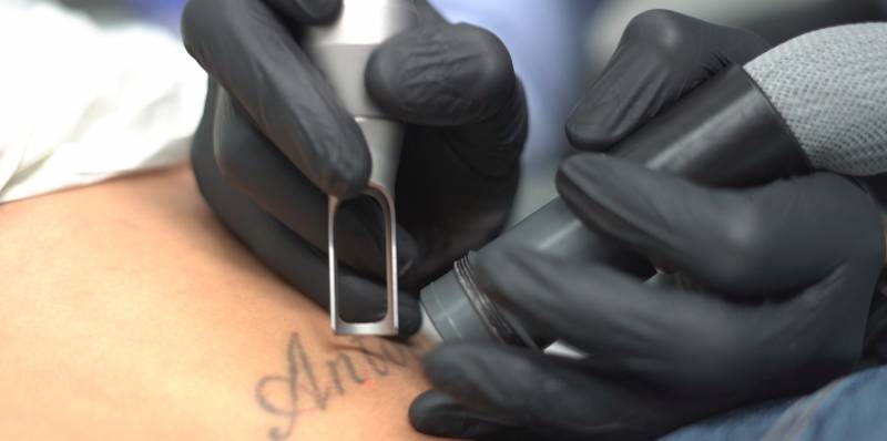 detatouage laser aix en provence medecin