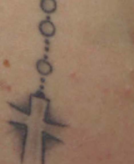 Détatouage laser picoseconde à Aix-en-Provence plus rapide, plus efficace